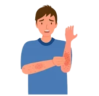 allergy